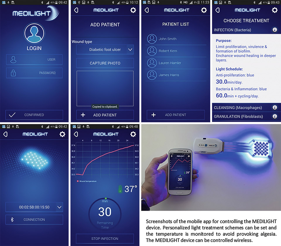 Figure 11: Screenshots of the developed mobile app which allows to control the illumination device