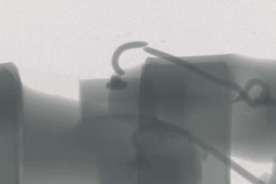 Figure 4: X-ray microscopy image of a broken bond wire.