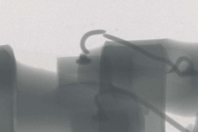 Figure 4: X-ray microscopy image of a broken bond wire.