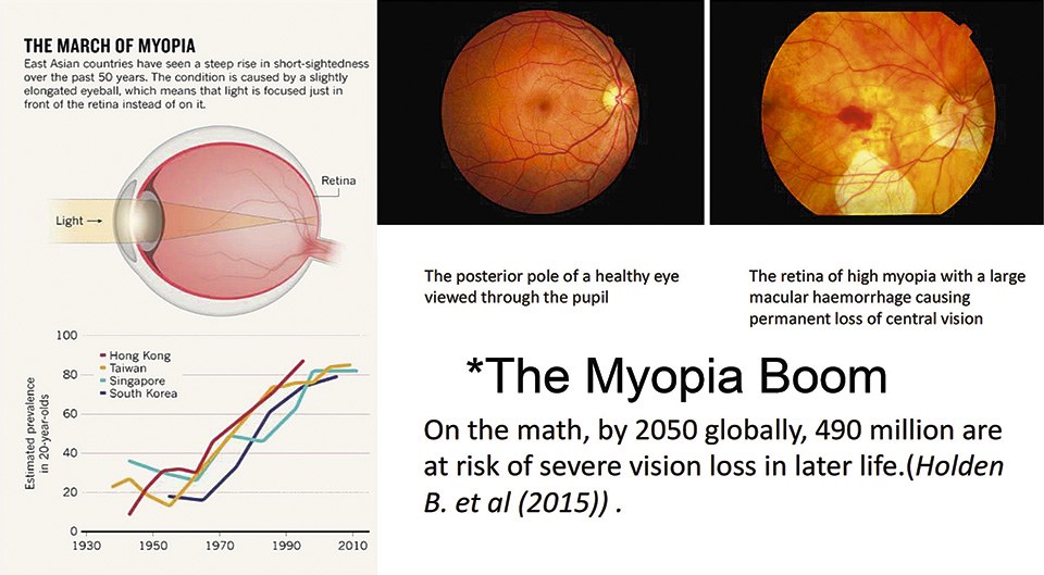 Blue light at 480 nm may reduce the risk of myopia