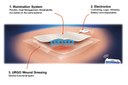 Flex LED Based Smart Light System for Healing of Chronic Wounds