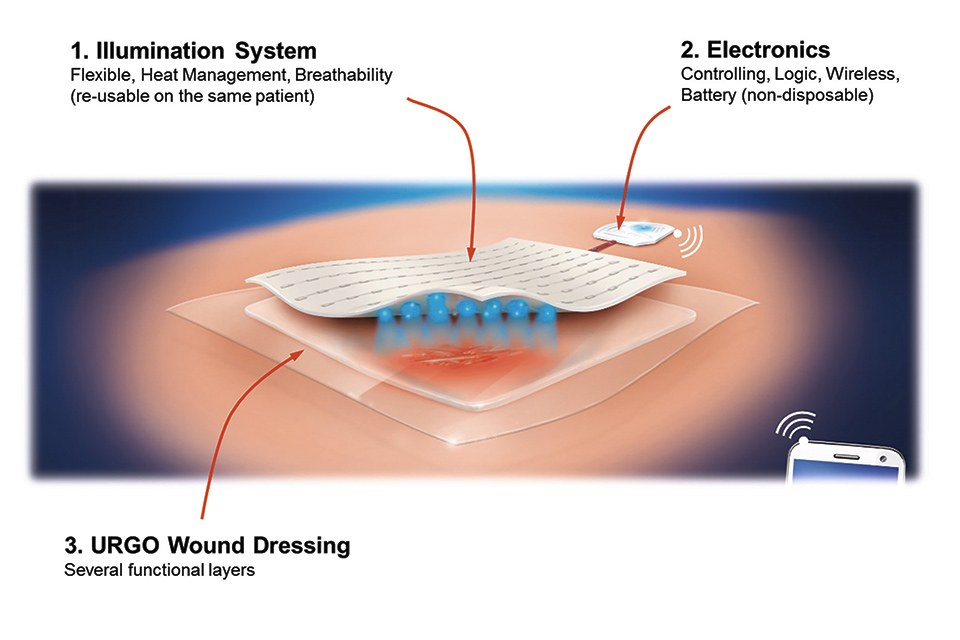 Flex LED Based Smart Light System for Healing of Chronic Wounds 